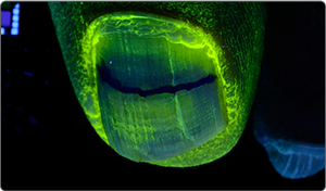 UV light after application 2