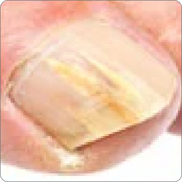 Toenail